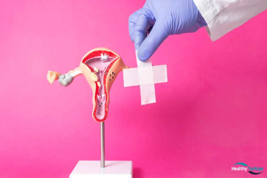 The Expertise Behind Labiaplasty in Turkey